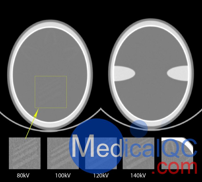 QRM-Cranial-CT-Phantom，顱腦CT模型，Cranial CT Phantom